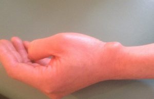 Vĩnh Viễn Cô Độc Trên Một Con Đường, Tôi Lầm Lũi Bước ĐI ….