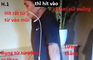 TAM NGUYÊN PHỤC MỆNH PHƯƠNG – Ứng dụng kết hợp liệu pháp “Thở bụng- Thổi chai” trong việc hỗ trợ điều trị bệnh Suy Thận (Đào Tạo Bác Sĩ Tự Thân)- Phần 2