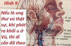 Để đó chơi!!!!! (“Nhũ Ung Tán”)